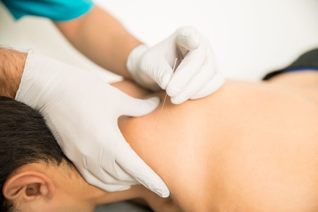 What to Expect From a TMJ Acupuncture Session