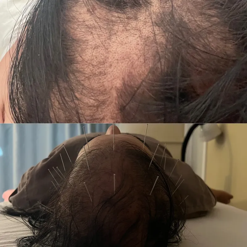 Mindful Healing Heart transformation result