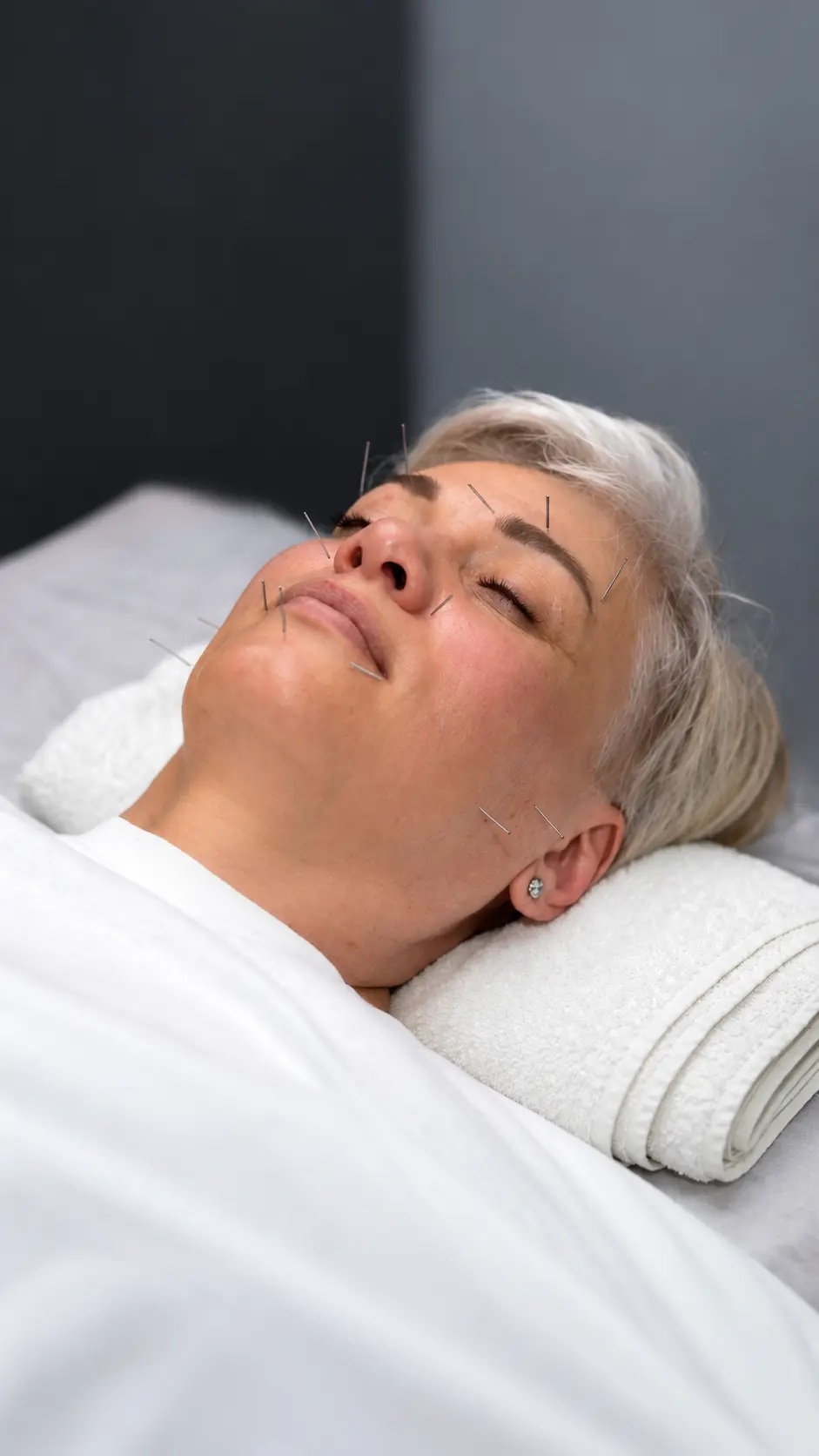 Cosmetic acupuncture facial treatment at Mindful Healing Heart, Pasadena